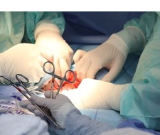 Surgical procedure